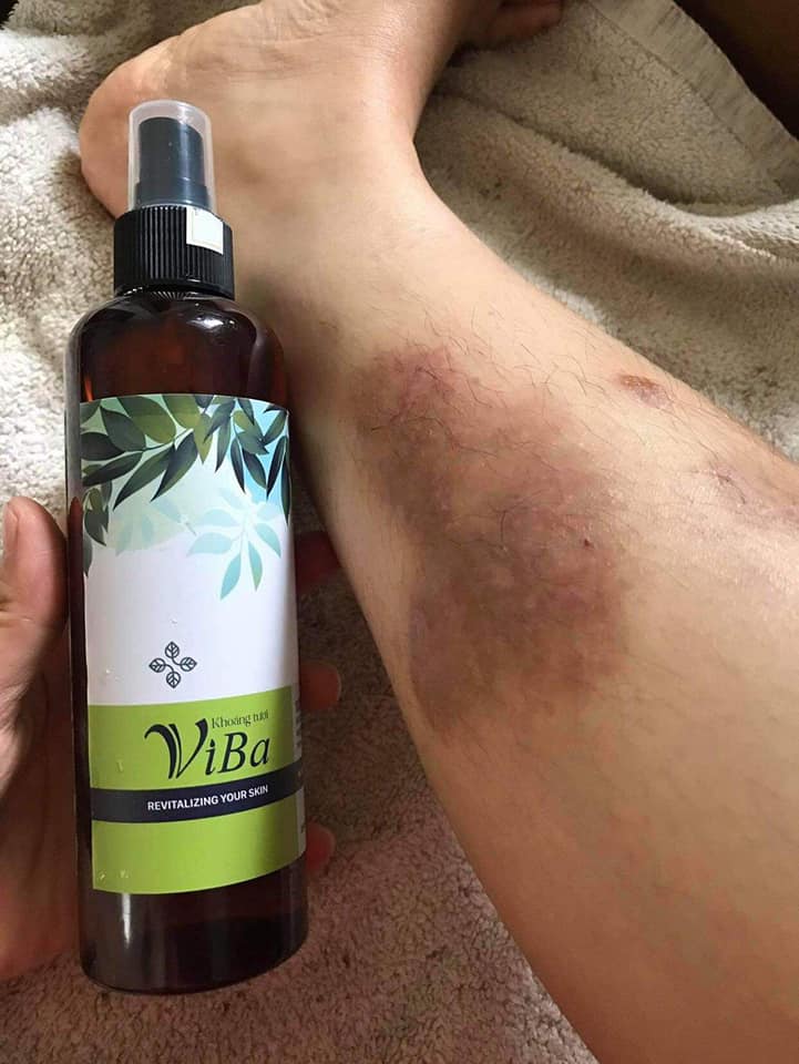 Khoáng tươi viba mỹ phẩm làm đẹp liệu trình chăm sóc da tự nhiên