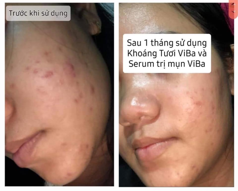 Skin care tự nhiên khoe mặt mộc khỏe đẹp không app rạng ngời