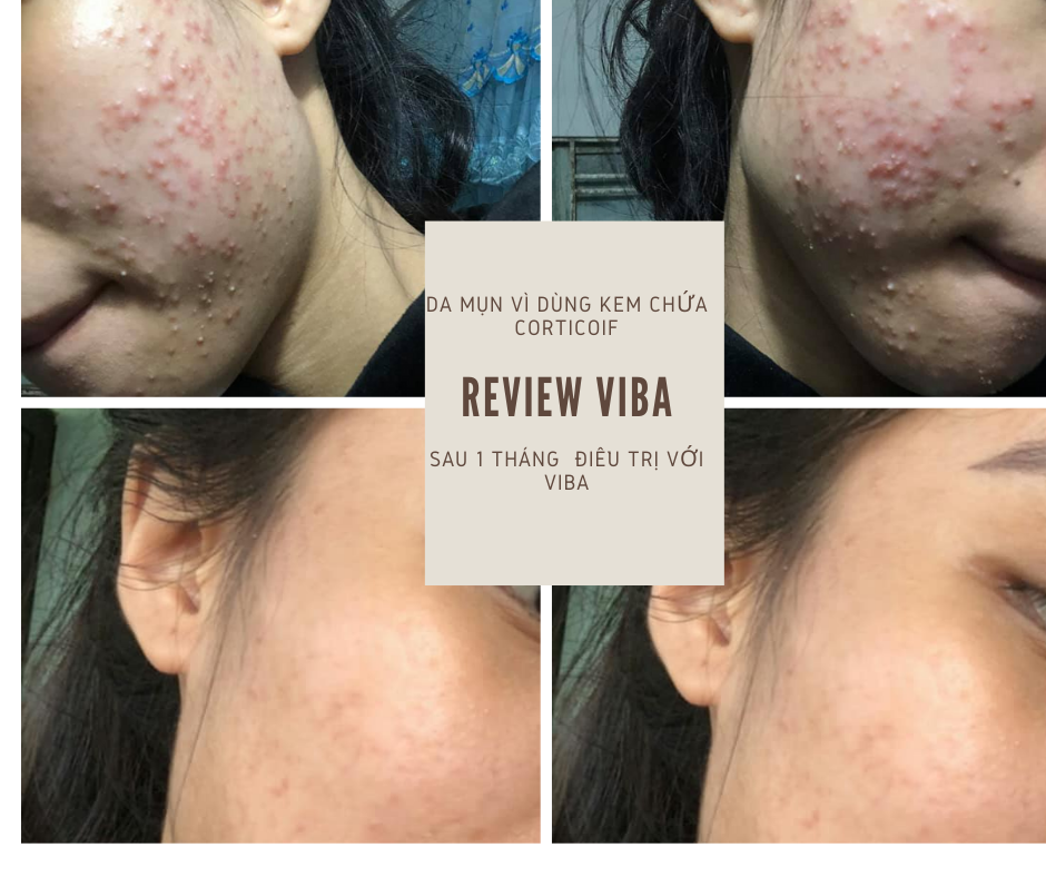 Khoáng tươi viba review - từ nguồn khoáng thiên nhiên của Việt Nam có tốt không?