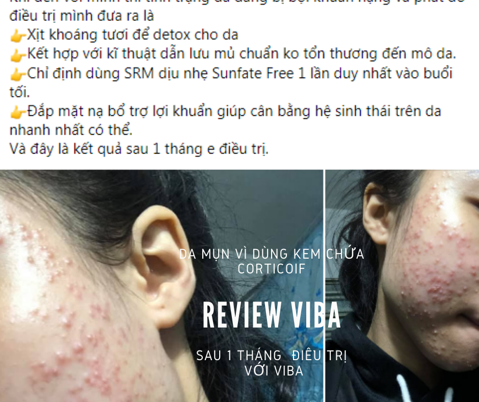 Khoáng tươi viba review - từ nguồn khoáng thiên nhiên của Việt Nam có tốt không?
