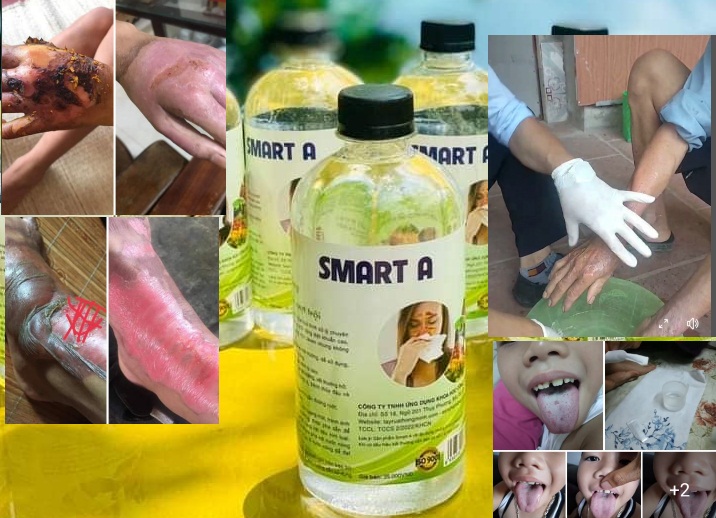 Smart A (Nước A - Anolyte) nước muối điện hoá hoạt hoá sát khuẩn 500ml