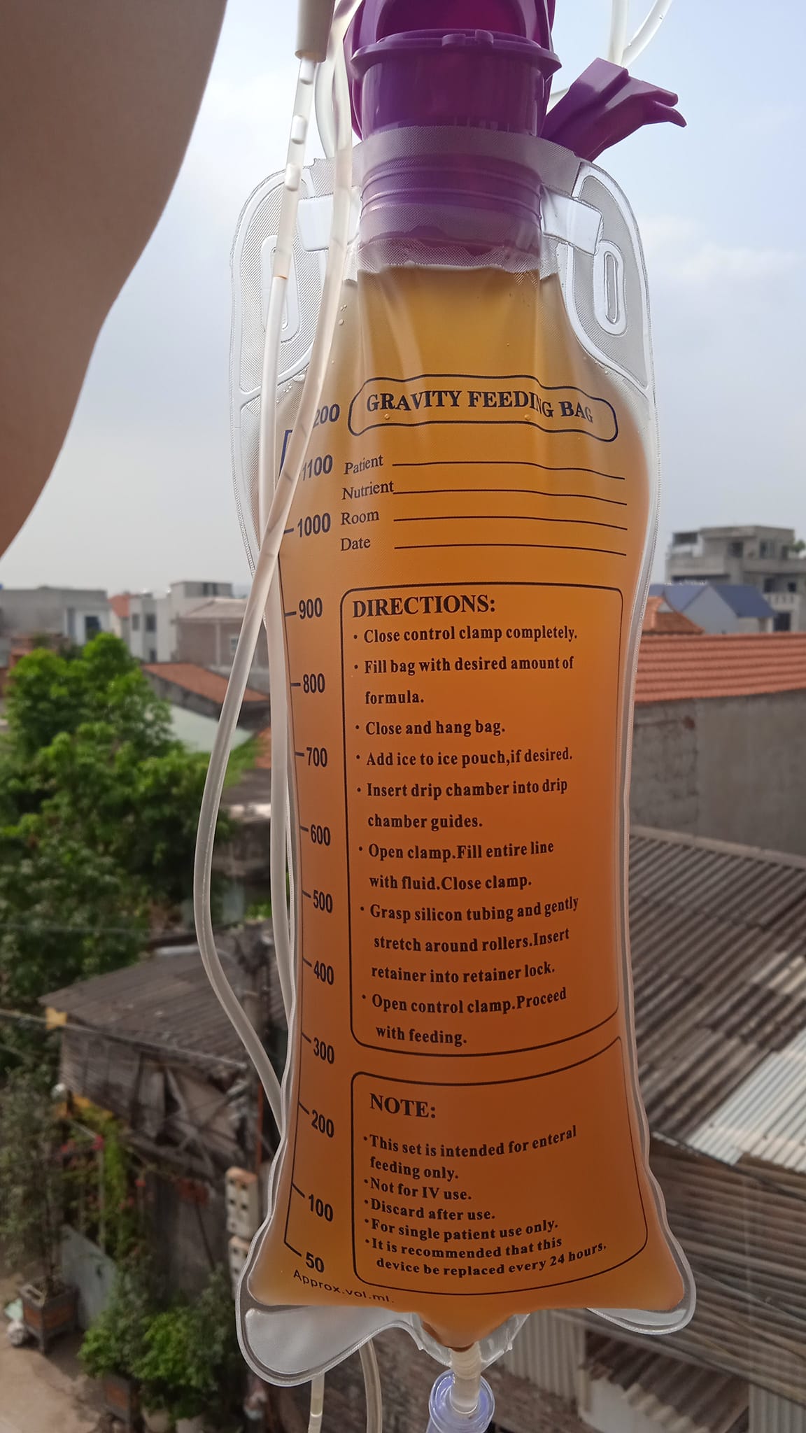 Mua dụng cụ thải độc đại tràng bằng cafe tại nhà hàng triệu người trên thế giới đang sử dụng